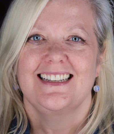 face - Dr Nina Shaffie