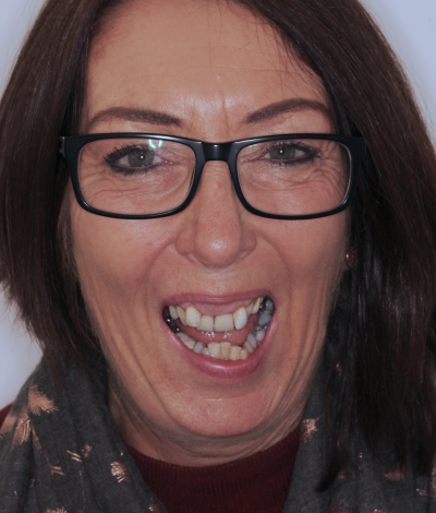 face - Dr Nina Shaffie