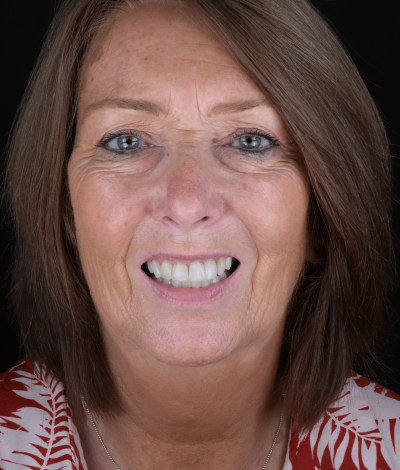 face - Dr Nina Shaffie