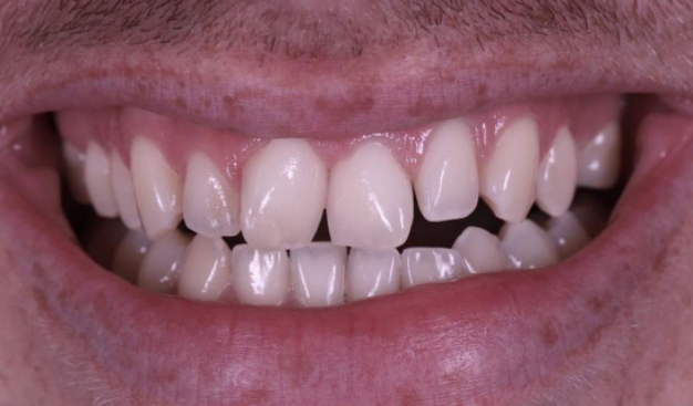 face - Dr Nina Shaffie