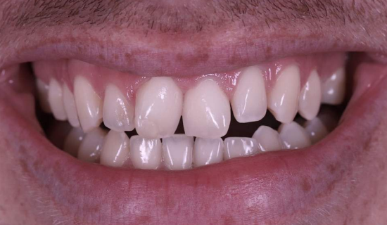 face - Dr Nina Shaffie