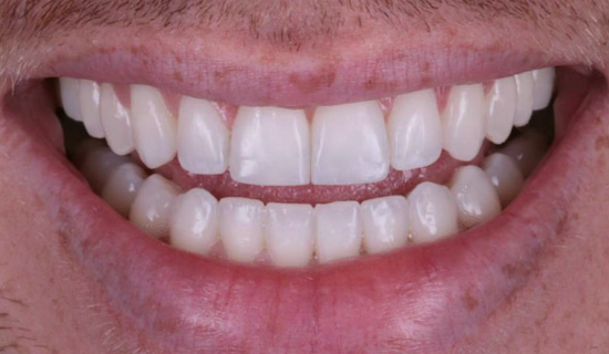 face - Dr Nina Shaffie