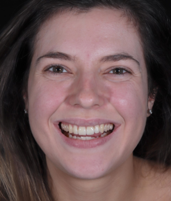 face - Dr Nina Shaffie