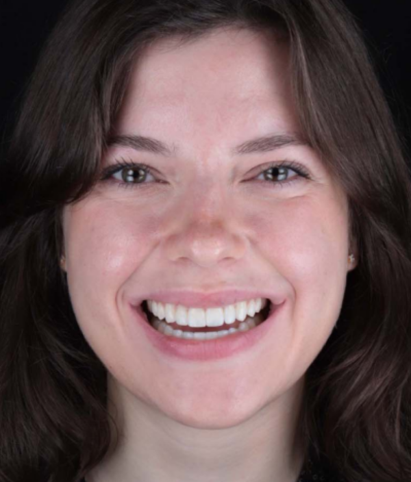 face - Dr Nina Shaffie