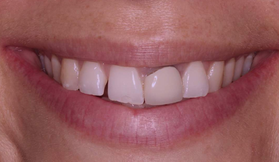 face - Dr Nina Shaffie