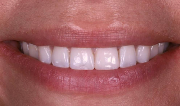 face - Dr Nina Shaffie