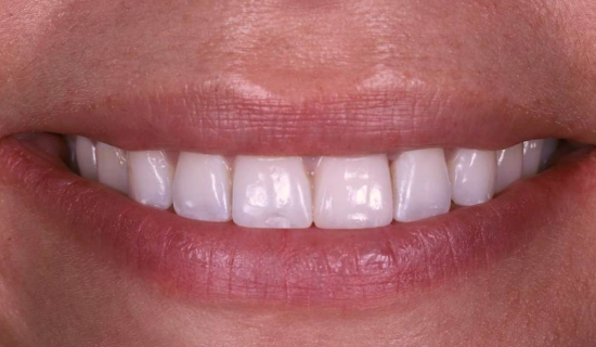 face - Dr Nina Shaffie