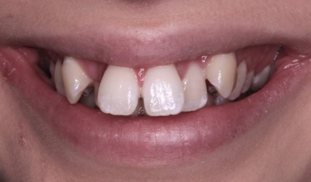 face - Dr Nina Shaffie