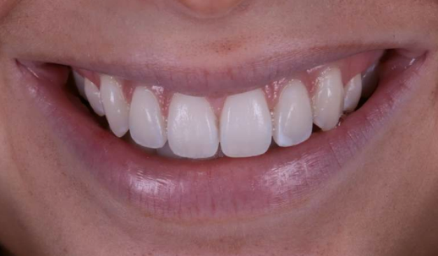 face - Dr Nina Shaffie