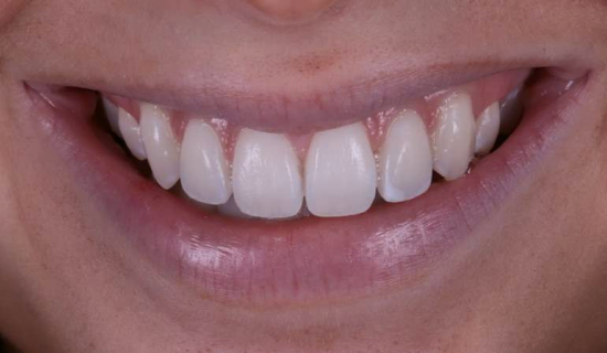 face - Dr Nina Shaffie