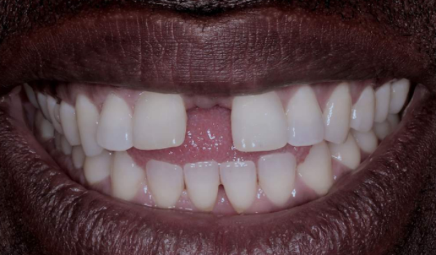 face - Dr Nina Shaffie