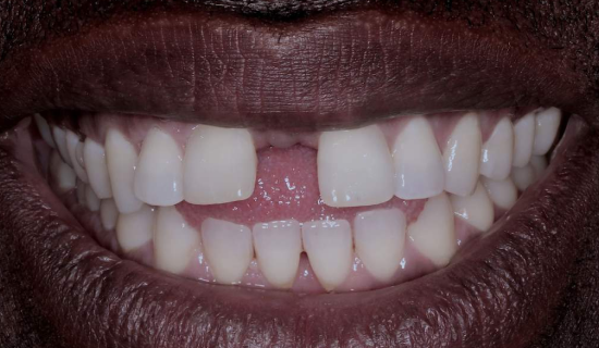 face - Dr Nina Shaffie