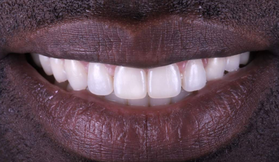 face - Dr Nina Shaffie