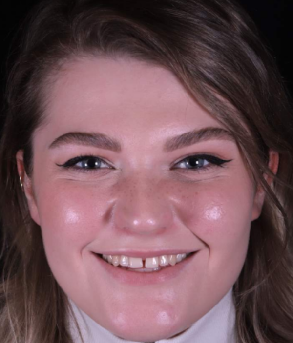 face - Dr Nina Shaffie