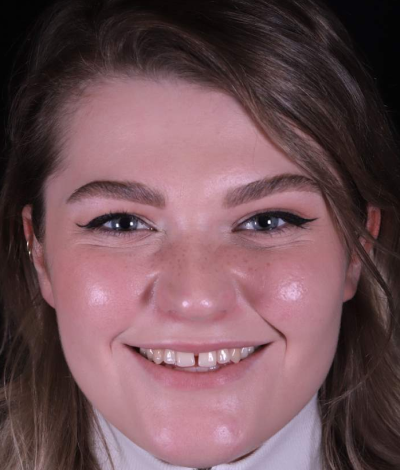 face - Dr Nina Shaffie