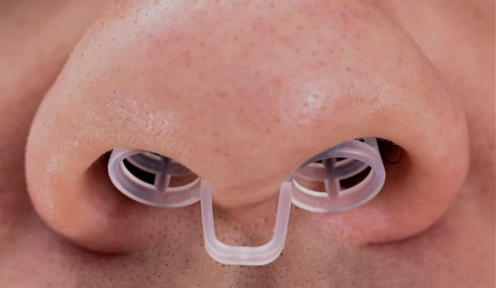 Treatment -  Dr Nina Shaffie