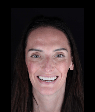 face - Dr Nina Shaffie