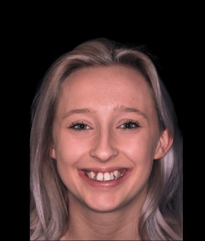 face - Dr Nina Shaffie