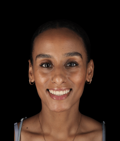 face - Dr Nina Shaffie