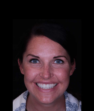face - Dr Nina Shaffie