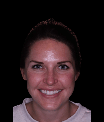 face - Dr Nina Shaffie