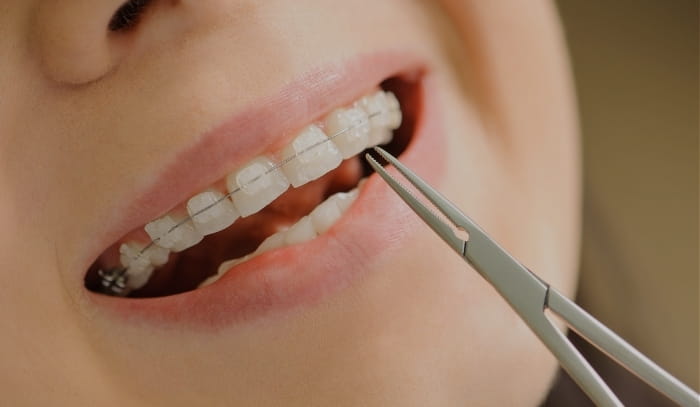 Treatment -  Dr Nina Shaffie