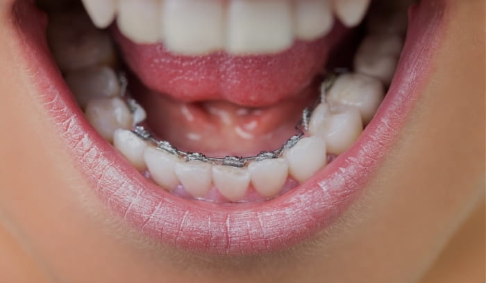 Treatment -  Dr Nina Shaffie