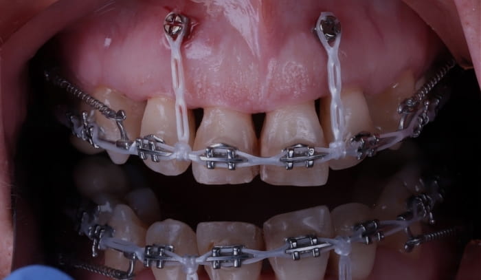 Treatment -  Dr Nina Shaffie