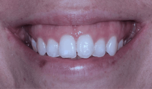 face - Dr Nina Shaffie