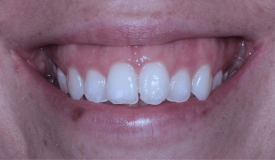 face - Dr Nina Shaffie