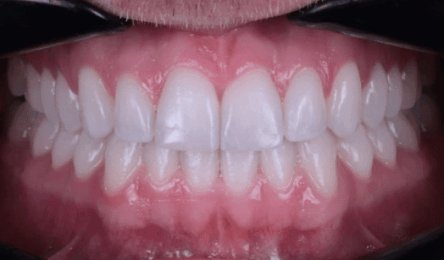 face - Dr Nina Shaffie
