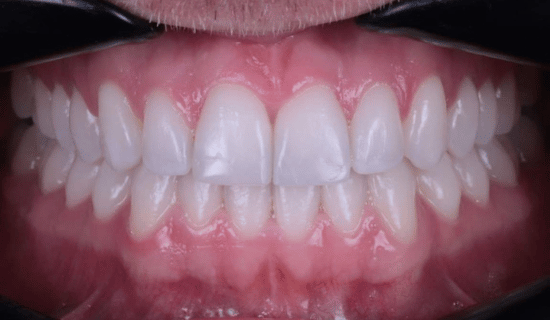 face - Dr Nina Shaffie