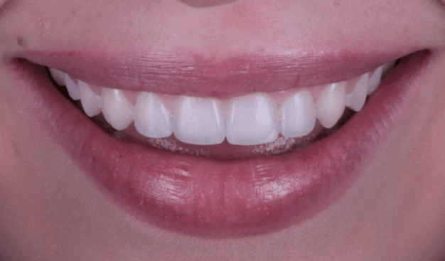 face - Dr Nina Shaffie