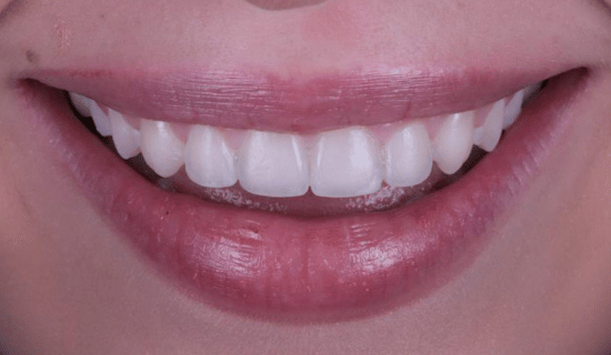 face - Dr Nina Shaffie
