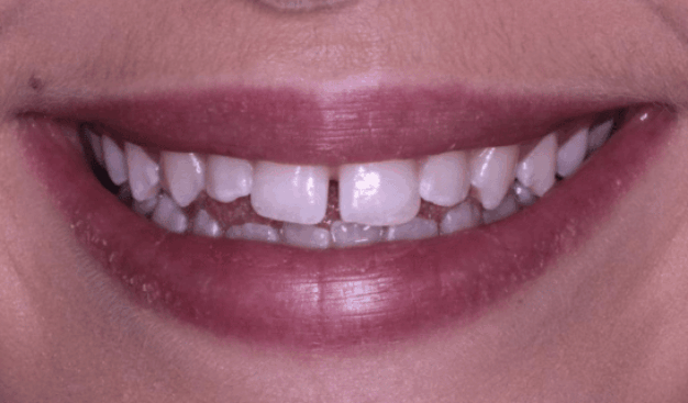 face - Dr Nina Shaffie