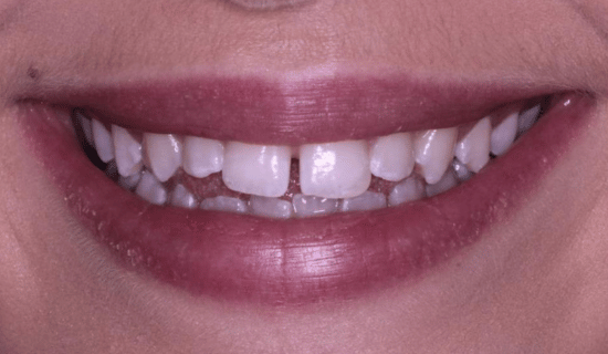face - Dr Nina Shaffie