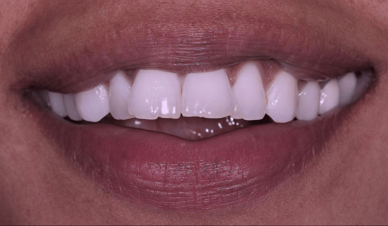 face - Dr Nina Shaffie