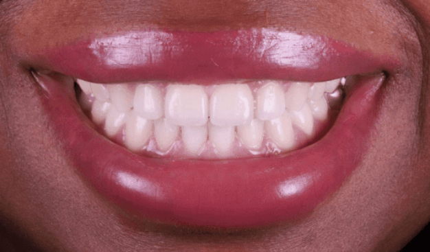 face - Dr Nina Shaffie