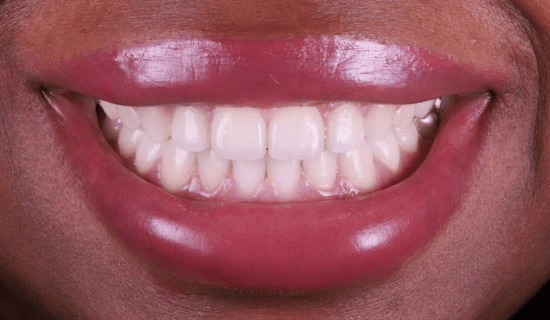 face - Dr Nina Shaffie