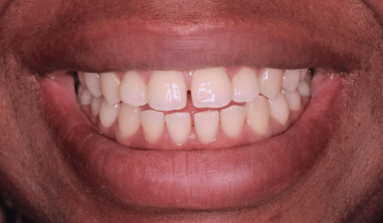 face - Dr Nina Shaffie