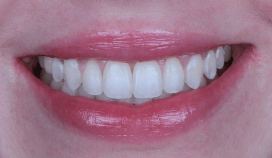 face - Dr Nina Shaffie