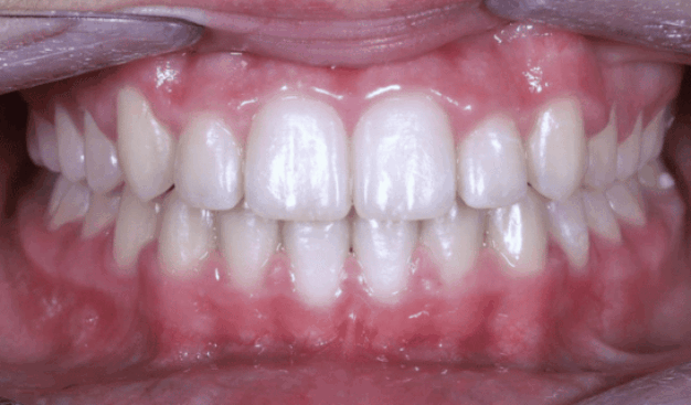 face - Dr Nina Shaffie