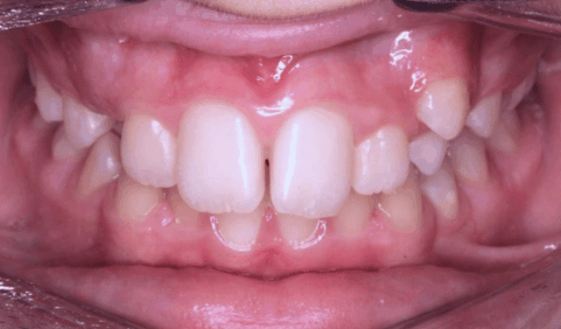 face - Dr Nina Shaffie