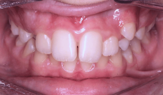 face - Dr Nina Shaffie