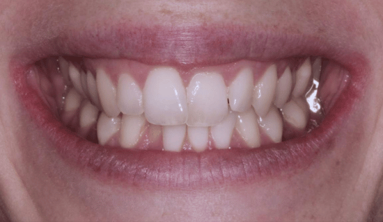 face - Dr Nina Shaffie