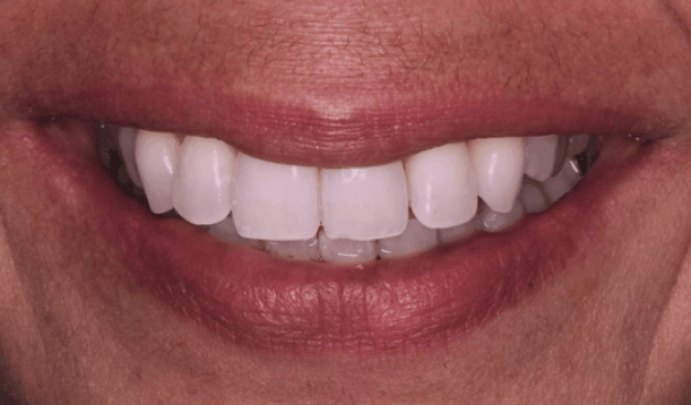 face - Dr Nina Shaffie