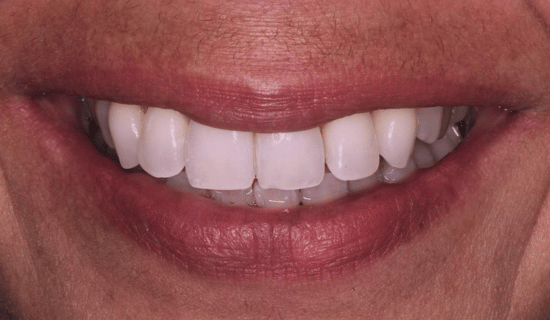 face - Dr Nina Shaffie