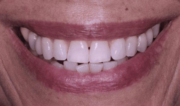 face - Dr Nina Shaffie