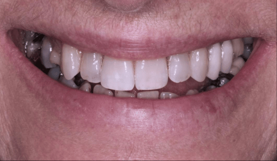 face - Dr Nina Shaffie