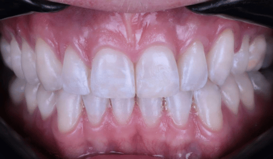 face - Dr Nina Shaffie
